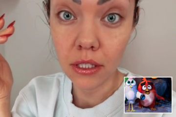 Mulher fica horrorizada após Botox dar errado e deixá-la com cara de Angry Bird